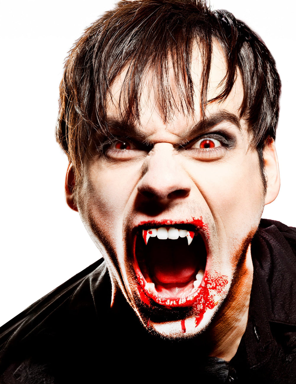 Mise en situation des dents fixées avec l'adhésif thermoplastique pour dents de vampire