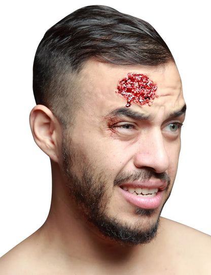 Lažno okužena rana